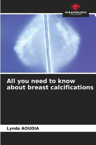 Cover image for All you need to know about breast calcifications