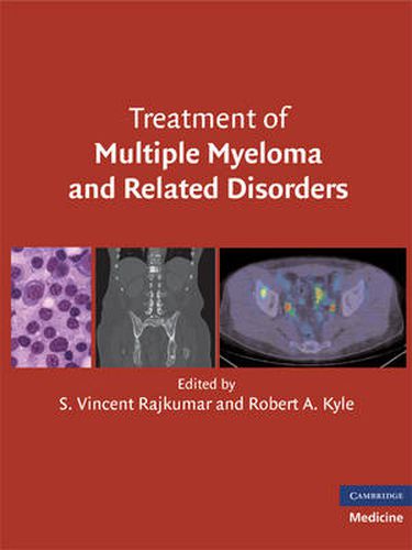 Cover image for Treatment of Multiple Myeloma and Related Disorders