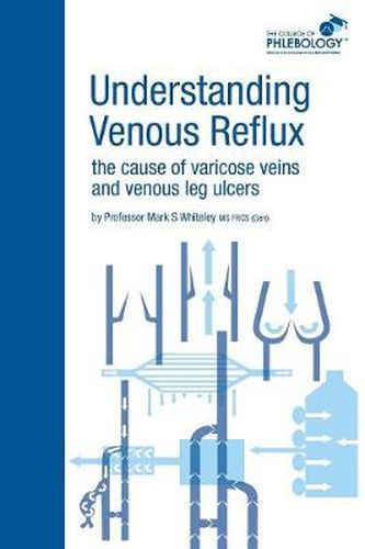 Cover image for Understanding Venous Reflux the Cause of Varicose Veins and Venous Leg Ulcers