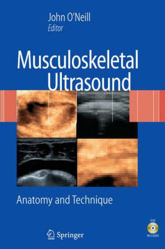 Cover image for Musculoskeletal Ultrasound: Anatomy and Technique