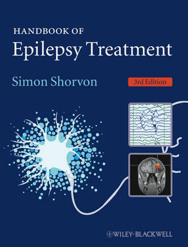 Cover image for Handbook of Epilepsy Treatment