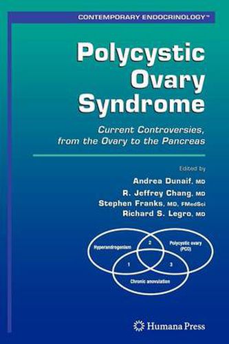 Polycystic Ovary Syndrome: Current Controversies, from the Ovary to the Pancreas