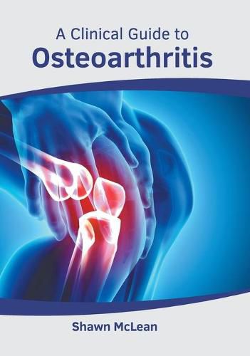 Cover image for A Clinical Guide to Osteoarthritis