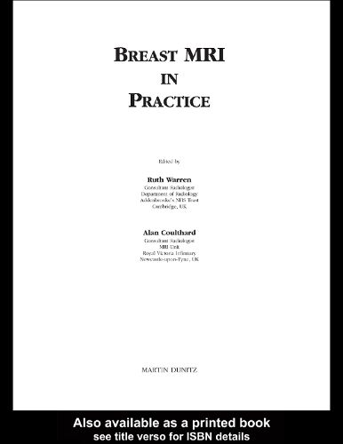 Cover image for Breast MRI in Practice