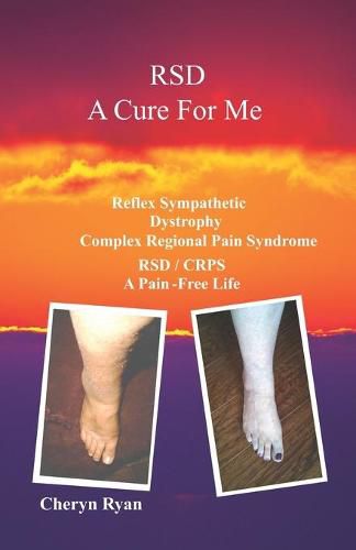 Cover image for Rsd a Cure for Me: Reflex Sympathetic Dystrophy Complex Regional Pain Syndrome Rsd/Crps a Pain-Free Life