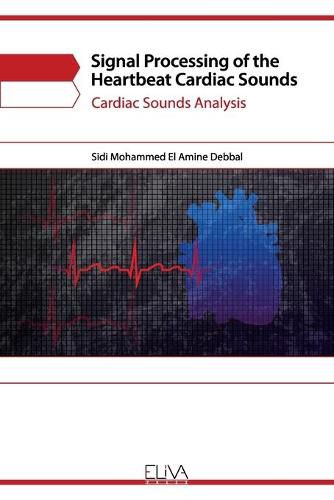 Cover image for Signal Processing of the Heartbeat Cardiac Sounds: Cardiac Sounds Analysis