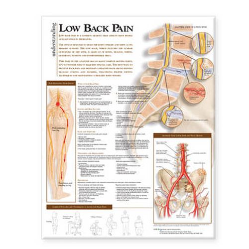 Cover image for Understanding Low Back Pain Anatomical Chart