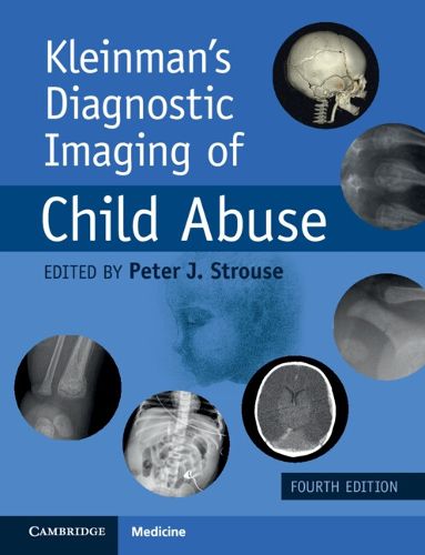 Cover image for Kleinman's Diagnostic Imaging of Child Abuse