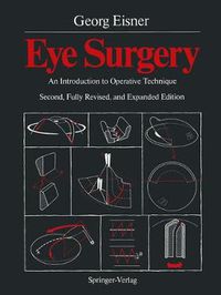 Cover image for Eye Surgery: An Introduction to Operative Technique