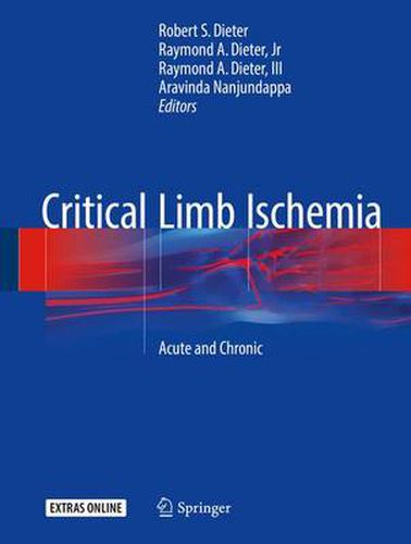 Cover image for Critical Limb Ischemia: Acute and Chronic