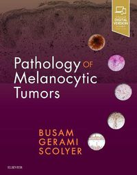 Cover image for Pathology of Melanocytic Tumors