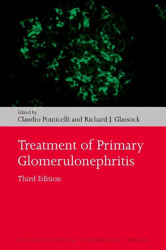 Cover image for Treatment of Primary Glomerulonephritis