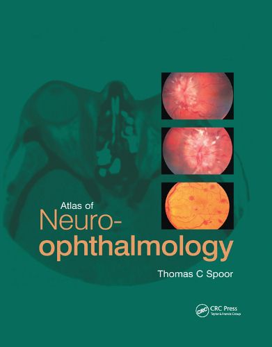 Cover image for Atlas of Neuro-ophthalmology