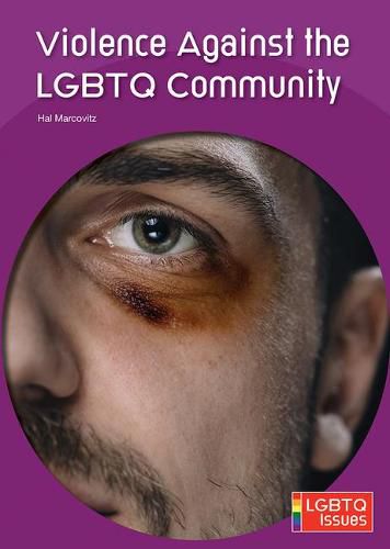 Violence Against the Lgbtq Community