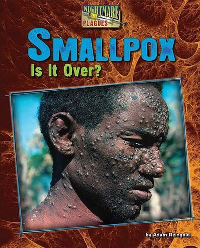Cover image for Smallpox: Is It Over?