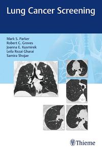 Cover image for Lung Cancer Screening