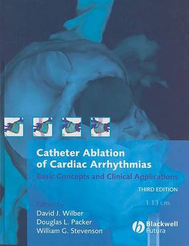 Catheter Ablation of Cardiac Arrhythmias: Basic Concepts and Clinical Applications