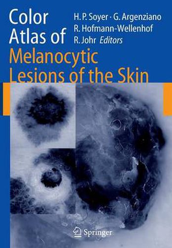 Cover image for Color Atlas of Melanocytic Lesions of the Skin