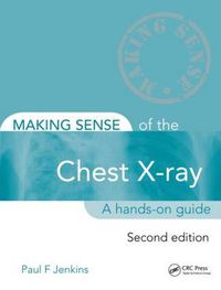 Cover image for Making Sense of the Chest X-ray: A hands-on guide