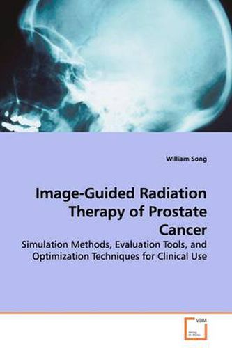 Cover image for Image-Guided Radiation Therapy of Prostate Cancer