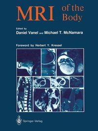 Cover image for MRI of the Body