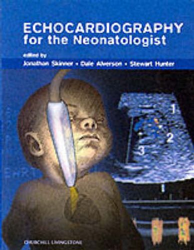 Echocardiography for the Neonatologist