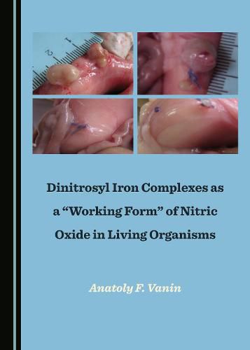 Dinitrosyl Iron Complexes as a  Working Form  of Nitric Oxide in Living Organisms