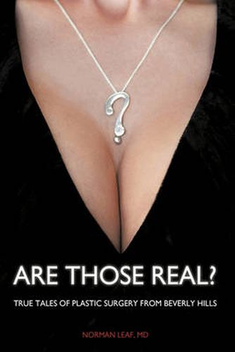 Cover image for Are Those Real?