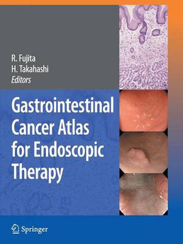 Cover image for Gastrointestinal Cancer Atlas for Endoscopic Therapy