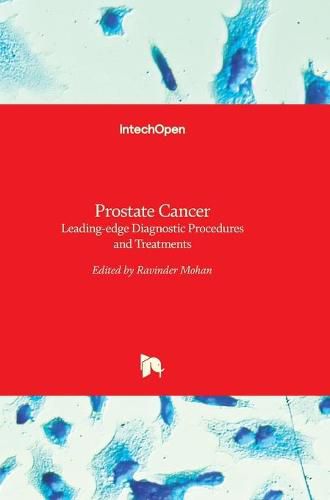 Cover image for Prostate Cancer: Leading-edge Diagnostic Procedures and Treatments