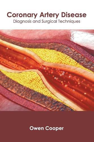 Cover image for Coronary Artery Disease: Diagnosis and Surgical Techniques