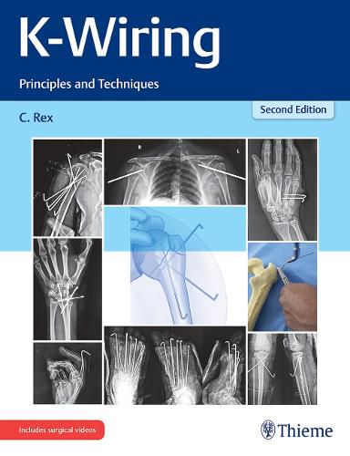 Cover image for K-Wiring: Principles and Techniques