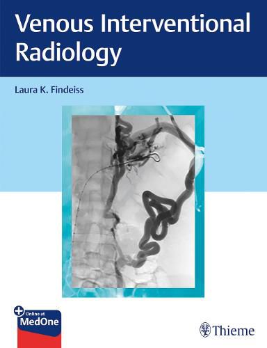 Cover image for Venous Interventional Radiology