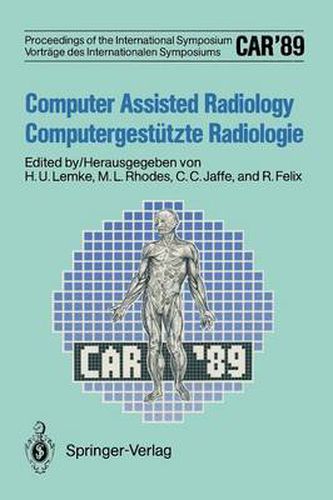 Cover image for CAR'89 Computer Assisted Radiology / Computergestutzte Radiologie: Proceedings of the 3rd International Symposium / vVortrage des 3. Internationalen Symposiums