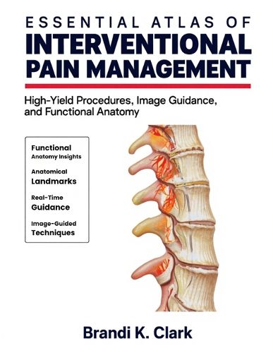 Cover image for Essential Atlas of Interventional Pain Management