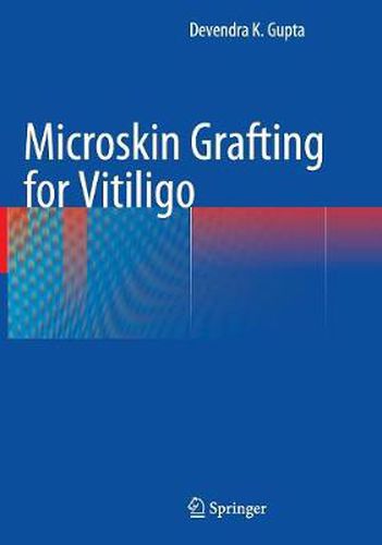 Cover image for Microskin Grafting for Vitiligo