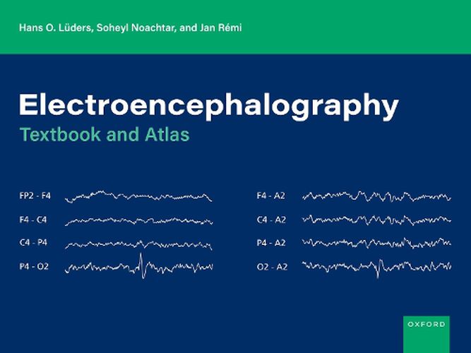 Cover image for Electroencephalography