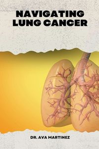 Cover image for Navigating Lung Cancer