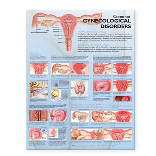 Cover image for Common Gynecological Disorders Anatomical Chart