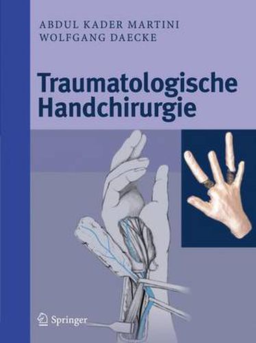 Cover image for Traumatologische Handchirurgie