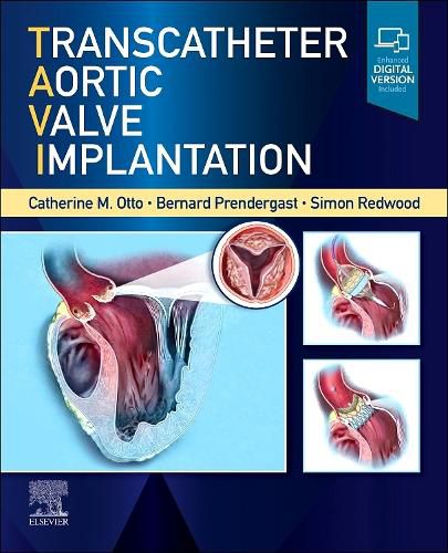 Transcatheter Aortic Valve Implantation