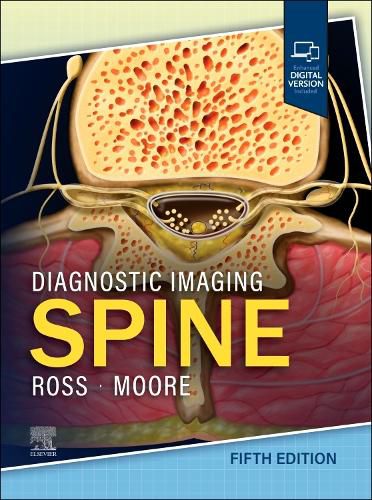 Cover image for Diagnostic Imaging: Spine