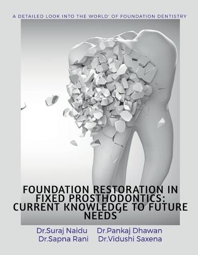 Cover image for Foundation Restoration in Fixed Prosthodontics