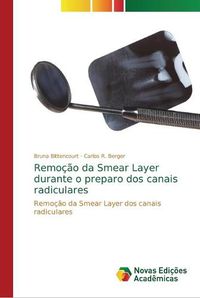 Cover image for Remocao da Smear Layer durante o preparo dos canais radiculares