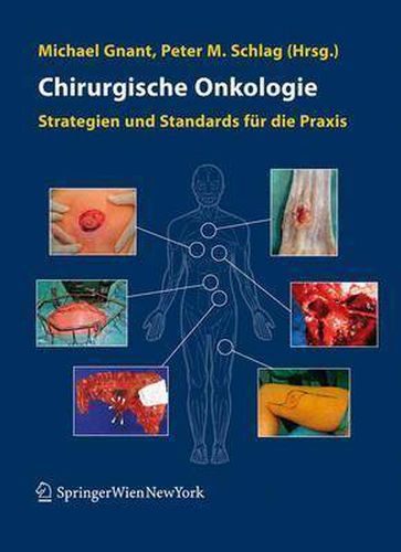 Cover image for Chirurgische Onkologie: Strategien und Standards fur die Praxis