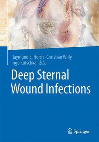 Cover image for Deep Sternal Wound Infections