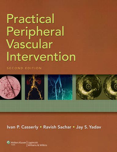 Cover image for Practical Peripheral Vascular Intervention