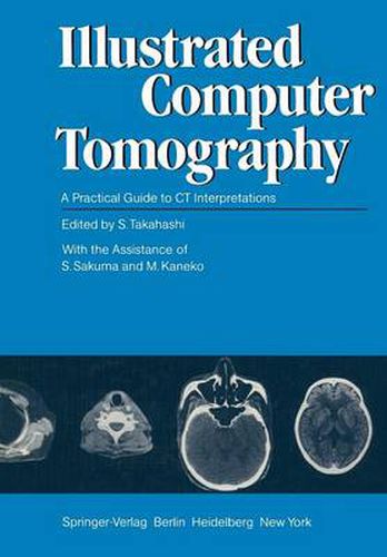 Illustrated Computer Tomography: A Practical Guide to CT Interpretations