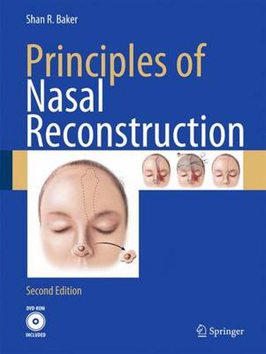 Cover image for Principles of Nasal Reconstruction