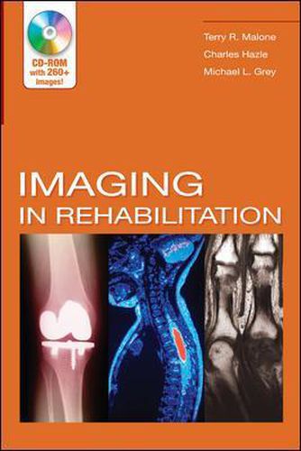 Imaging In Rehabilitation